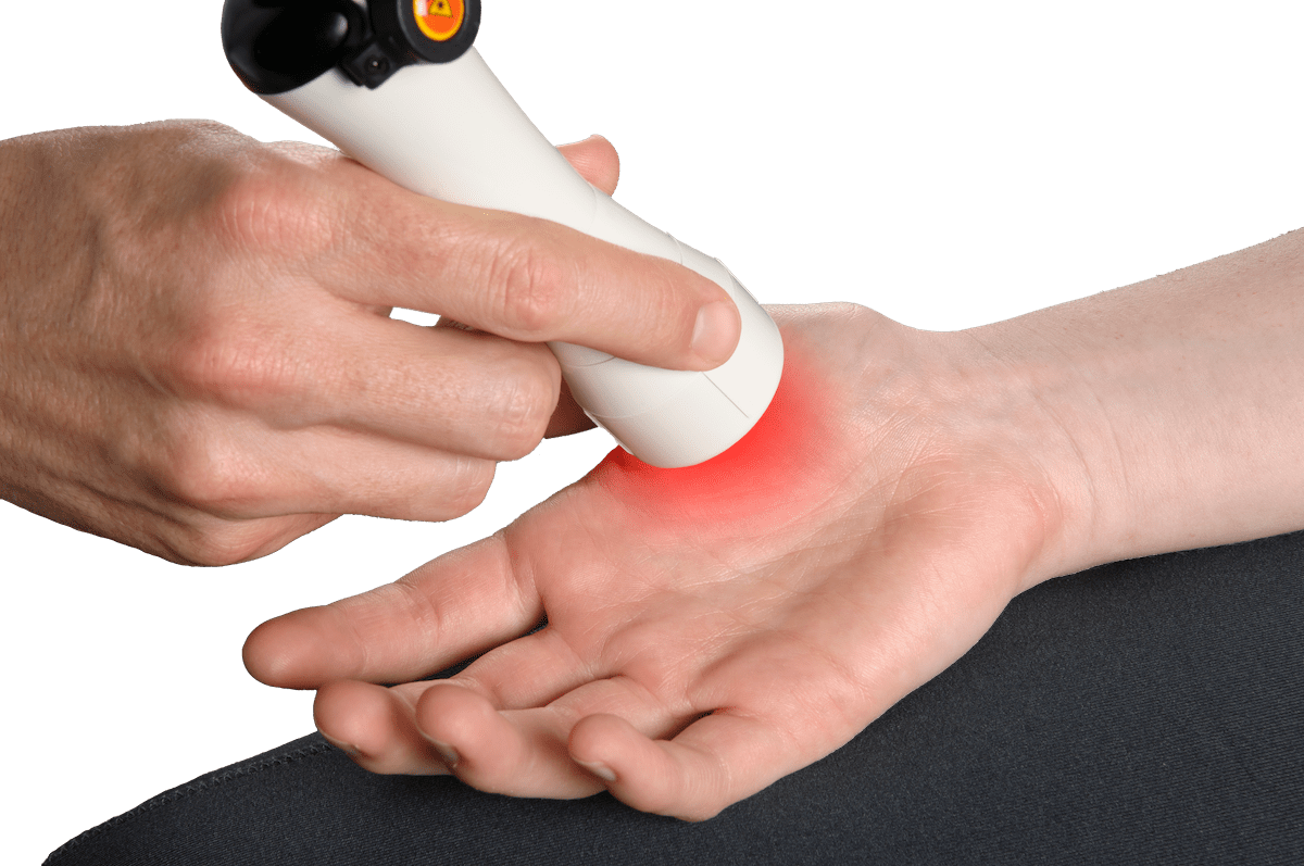 laser treatment for hand