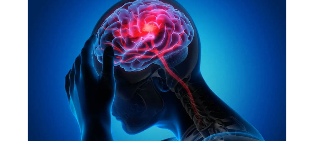 graphic showing cranial pain