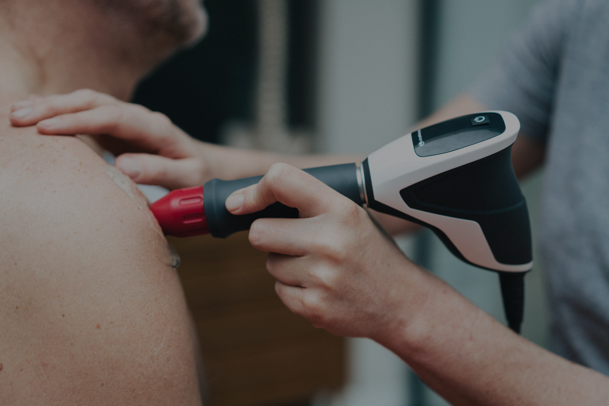 patient shoulder treated with rpw2 shockwave
